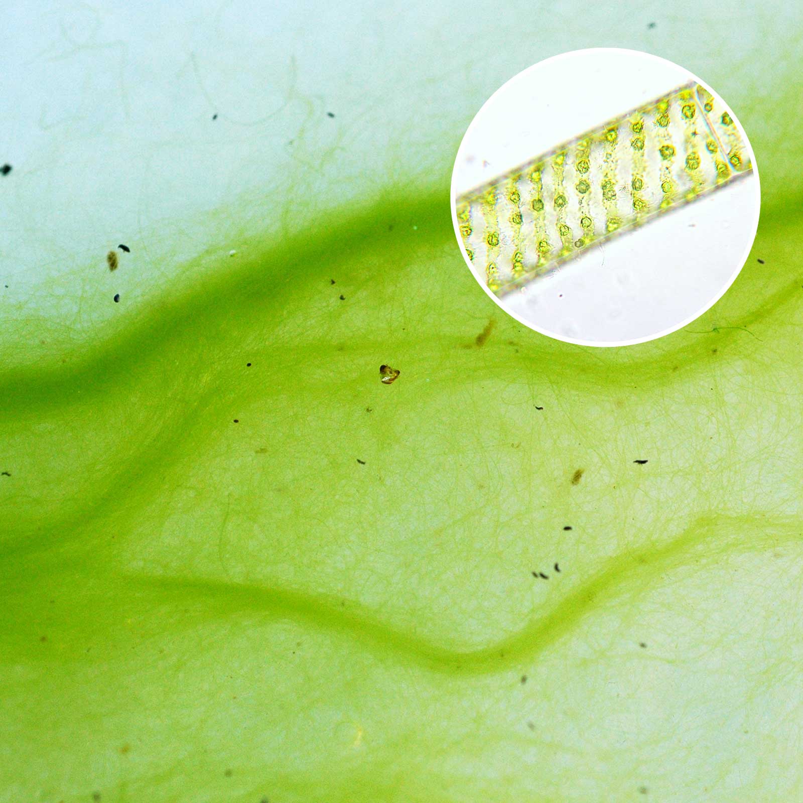 Spirogyra Algae in Ponds and Lakes